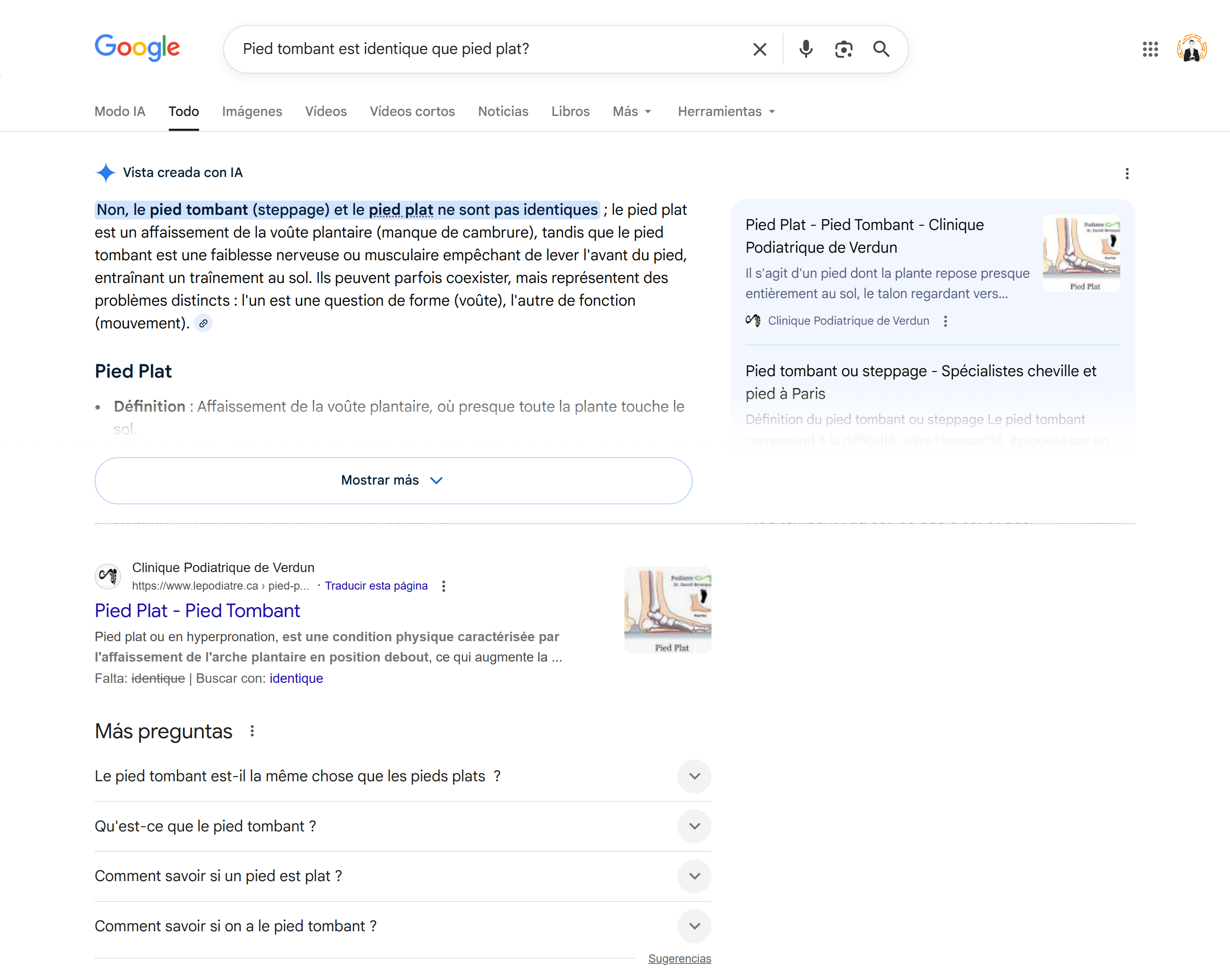 Résultats Google pour une requête médicale comparative (pied tombant vs pied plat)